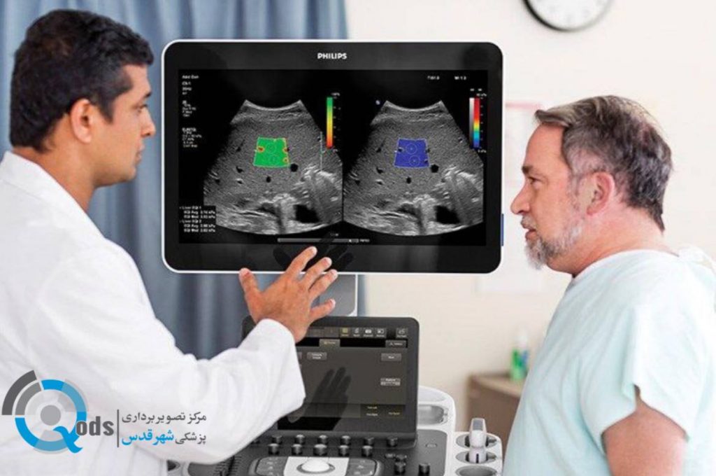 فیبرواسکن کبد ٫توده های پستان و تیروئید
